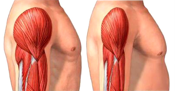 Une perte de poids n'est pas toujours optimale quand il sagit de masse musculaire Une perte de poids n'est pas toujours optimale quand il sagit de masse musculaire